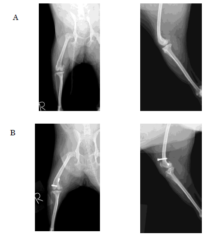 Fig.7　A:脛骨内旋制動術　術前Ｘ線　B: 脛骨内旋制動術　術後Ｘ線