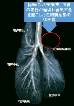 左肺前葉にみられた肺葉捻転の犬の１例 亀戸動物総合病院 墨田区 犬 猫の動物病院